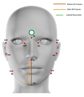 Facial and Mandibular Landmark Tracking with Habitual Head Posture Estimation using Linear and Fiducial Markers